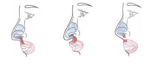 Az orrizmok egy részének csonkolása