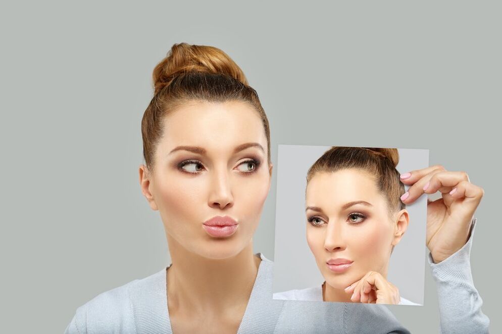 női arc orrplasztika előtt és után